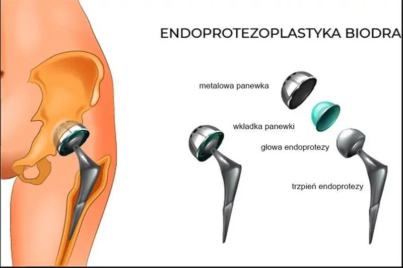 Bezpieczny powrót do aktywności fizycznej