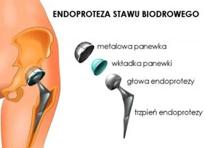Jazda na rowerze po operacji biodra